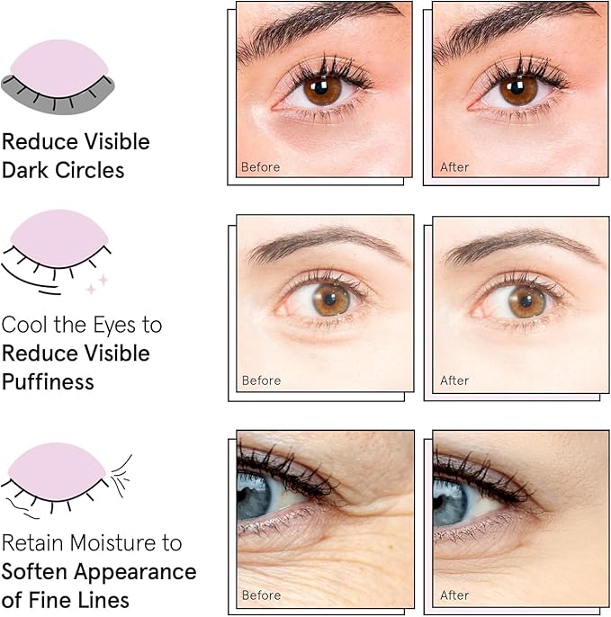 grace & stella Award Winning Under Eye Mask Reduce Dark Circles, Puffy Eyes, Undereye Bags, Wrinkles, Gel Under Eye Patches, Nurse Gifts, Vegan Cruelty-Free Self Care (6 Pairs, Blue)-Velvo Beauty