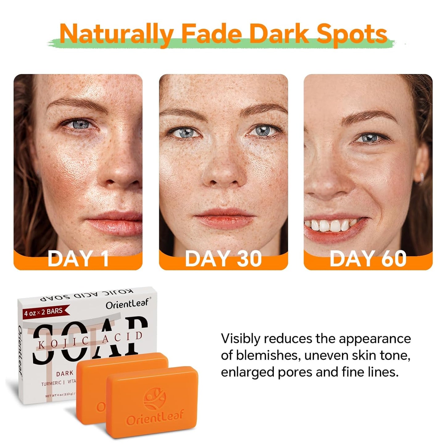 Kojic Acid and Turmeric Soap for Dark Spots Remover, Brightening, Hyperpigmentation for Face, 4oz x 2 BARS-Velvo Beauty