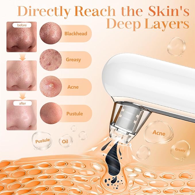 Yccu Blackhead Remover Vacuum Pore Extractor Black Head Remover for Face&Nose Blackhead Extractor Pore Vacuum Pimple Extractor Tool Pore Cleaner with USB Charge 4 Modes 5 Suction Heads for Women&Men-Velvo Beauty