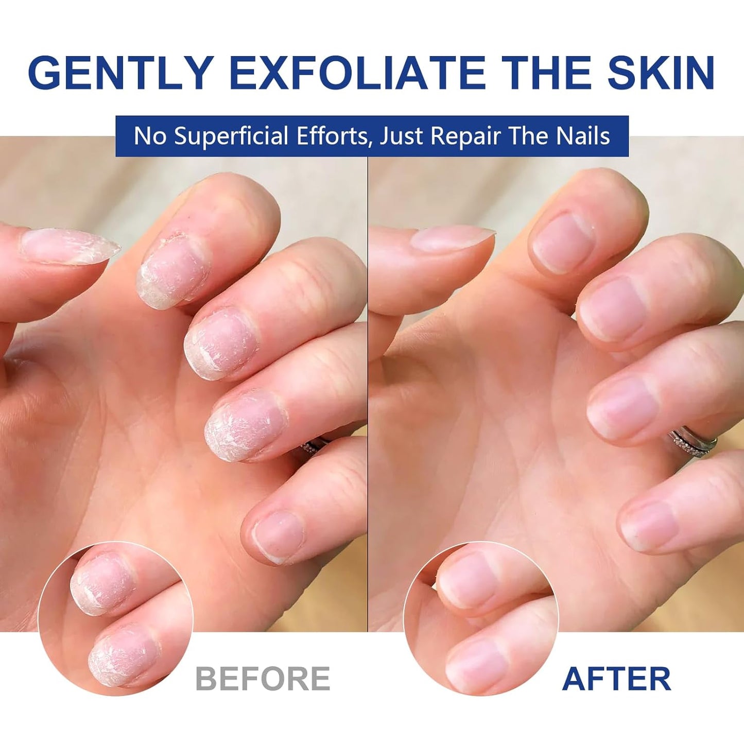 Nails Spray, New Tea Oil Extra-Strength Toenail Treatment, 7 Days Nail Treatment | Keeps Feet Fresh & Dry All Day | Men & Women (1 PCS)-Velvo Beauty