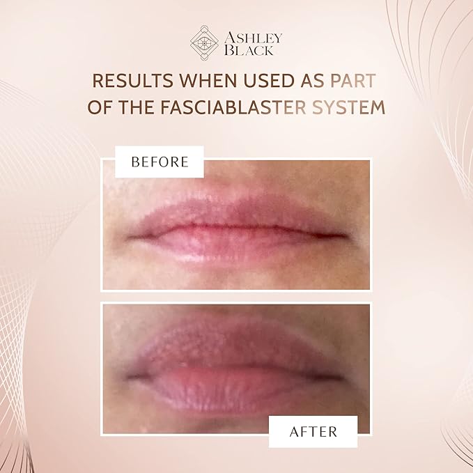 Maximum Lip Plump by Ashley Black - Plump and Hydrate Lips Instantly-Velvo Beauty