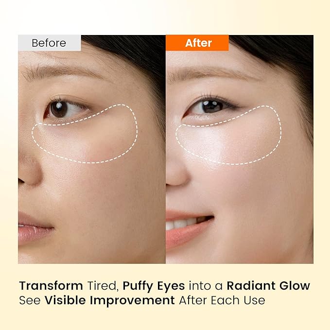 Caffeine Under Eye Patches: 30 Pairs Korean Hydrogel Eye Masks for Dark Circles Puffiness Relief with Niacinamide Hyaluronic Acid - Undereye Brightening Hydrating Anti-Wrinkle Treatment-Velvo Beauty