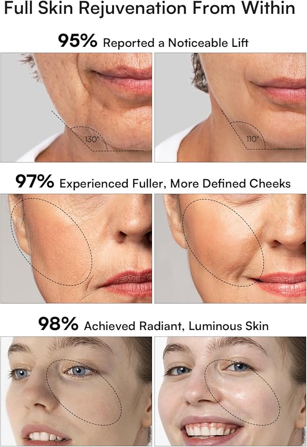 INIA Micro-Current Facial Device, 3-in-1 Facial Massager Red Light Therapy for Face and Neck True Beauty Glow Device Effective for Wrinkle and Puffiness-Velvo Beauty