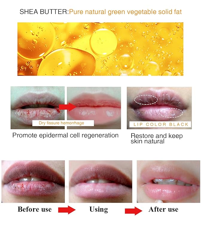 Moisture Lip Balm Lip Cream Hydrate Smooth Shea Butter Extract for Removing Dark Lip Promoting Skin Regeneration Making Lip Soft Tender & Autumn Winter Season Women Man Girl Boy Daily Lip Care-Velvo Beauty