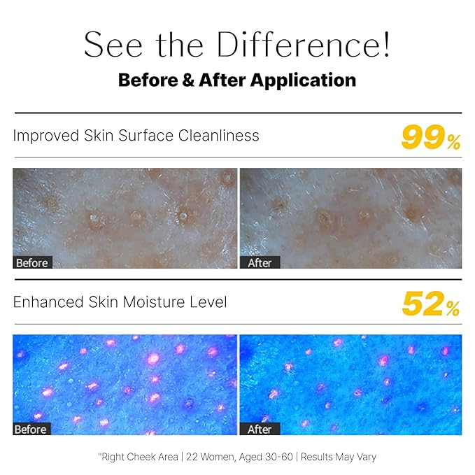 Lemon Honey Face Mask Wash-Off Pack & Scrub — 5-Minute, Exfoliating, Hydrating, Gentle for Sensitive Skin, with Manuka Honey & Lemon Extract, 3.52 oz (100 g)-Velvo Beauty