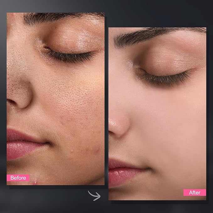 Carbonated Bubble Clay Mask -Exfoliation Face Mask | Detoxing Clay Mask for Blackhead Removal,Dull Skin,Skincare Facial Mask for Controlling Oil and Refining Pores,Mothers Day Gifts for Wife-Velvo Beauty