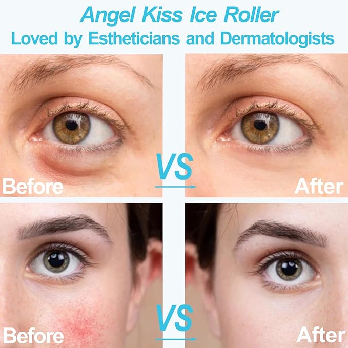 Angel Kiss Ice Roller for Face Eye, Women Gift Idea, Cold Therapy Massager for Reduce Puffiness, Redness, Dark Circles, Tightening Firming, Reduce Wrinkles, Migraine Pain Relief, w/Premium Carry Case-Velvo Beauty