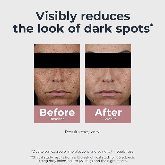 Eucerin Radiant Tone Night Cream, Dark Spot Corrector with Thiamidol, Night Moisturizer for Face Helps Visibly Reduce the Look of Persistent Dark Spots, All Skin Types, 1.7 Oz Bottle-Velvo Beauty