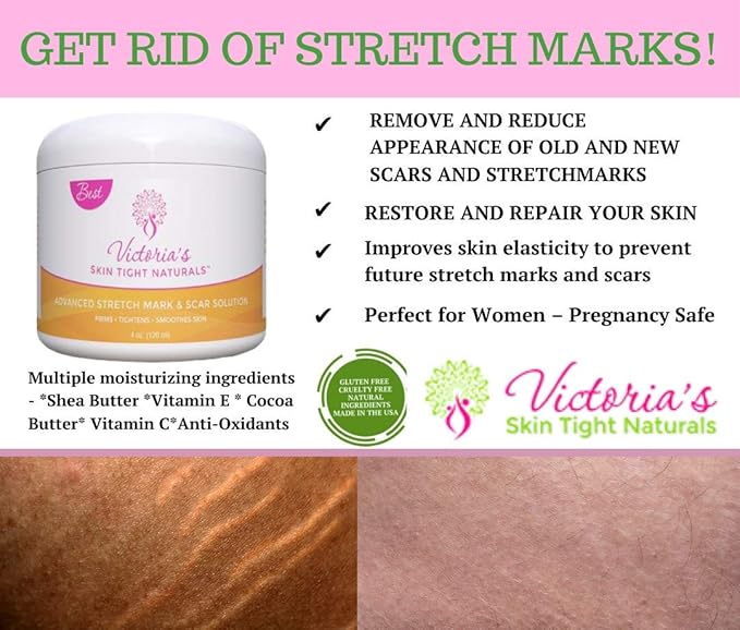 Best Stretch Marks Cream Prevent & Reduce Marks Reduce Pregnancy Stretch Marks Highly Concentrated Cream includes $29 Scar Reducing Guide-Velvo Beauty