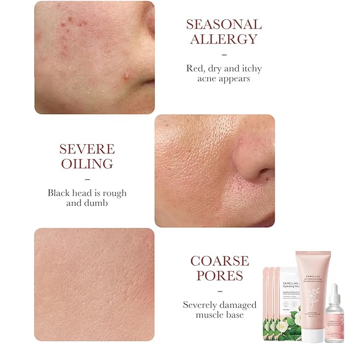 Camellia Extract Skin Care Sets, Skin Care Gift Set for Women Girls, Face Skin Care Routine Kit for Women, 5Pcs Skin Care Products Set with Cleanser,Mask, Face Serum-Velvo Beauty