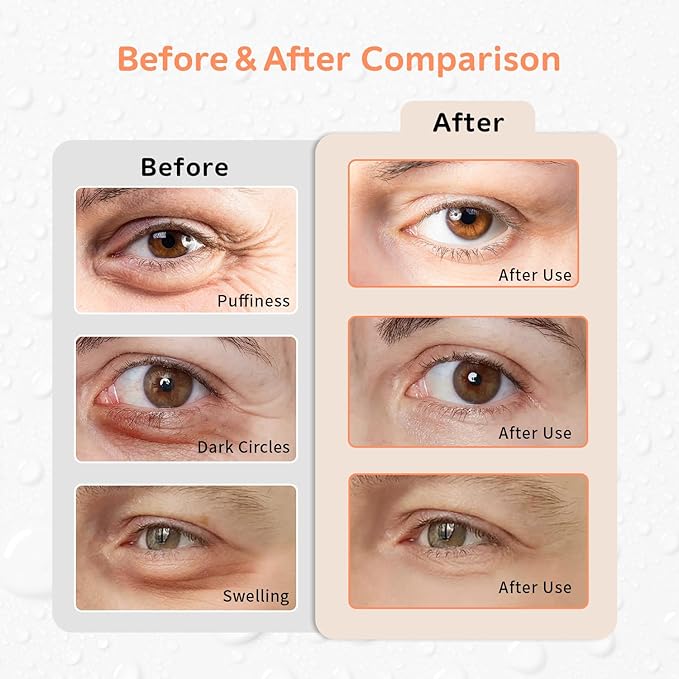 Gel Ice Pack Reusable Cooling Eye Pads and Under Patches,Eye Hot Cold Treatment for Redness,Pain Relief Relax (Oranges)-Velvo Beauty