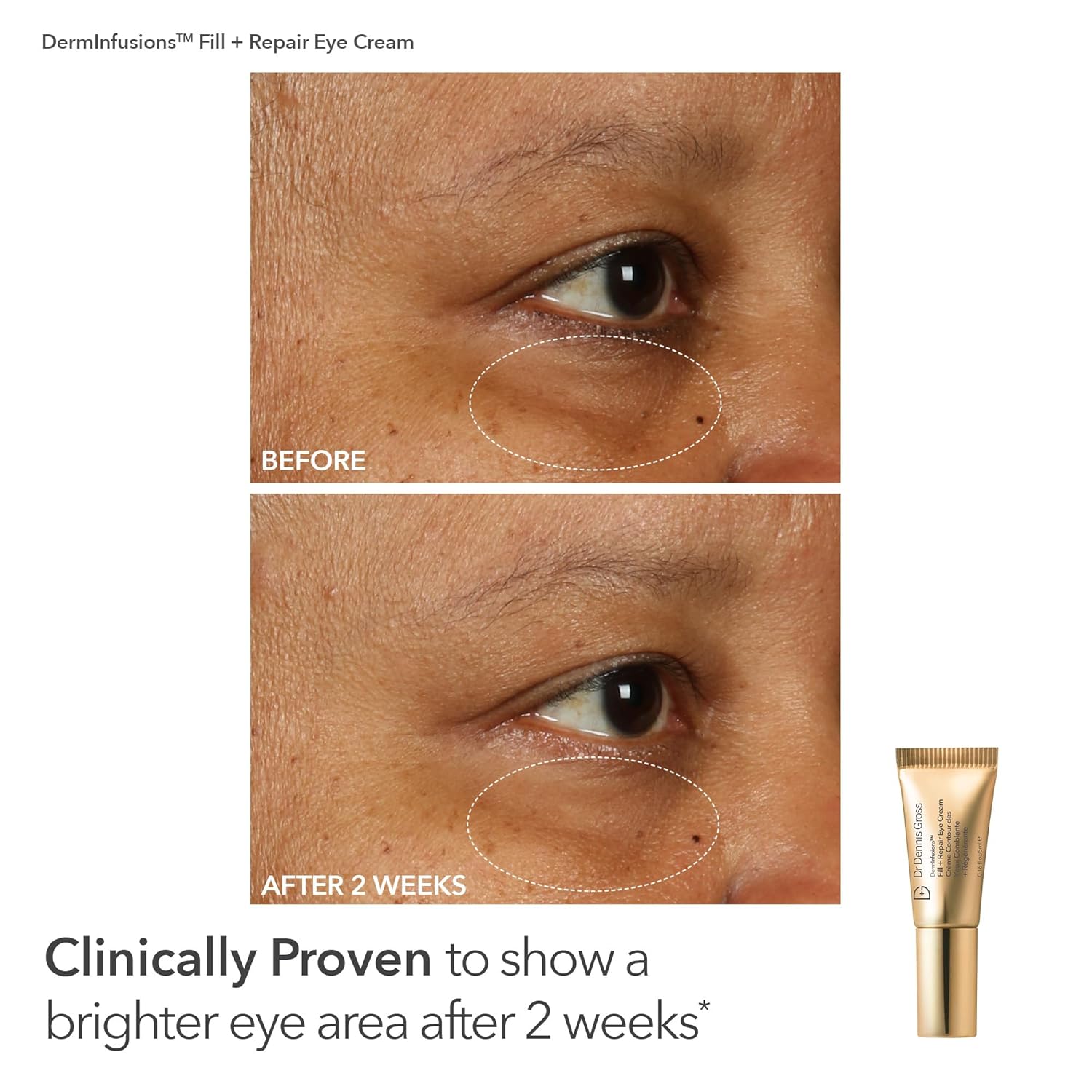 Dr. Dennis Gross Fill, Plump & Firm Kit – DermInfusions™ Hyaluronic Acid Serum, Eye Cream & Lip Treatment | Boost Hydration, Smooth Fine Lines & Enhance Volume | Limited Edition Gift Set-Velvo Beauty