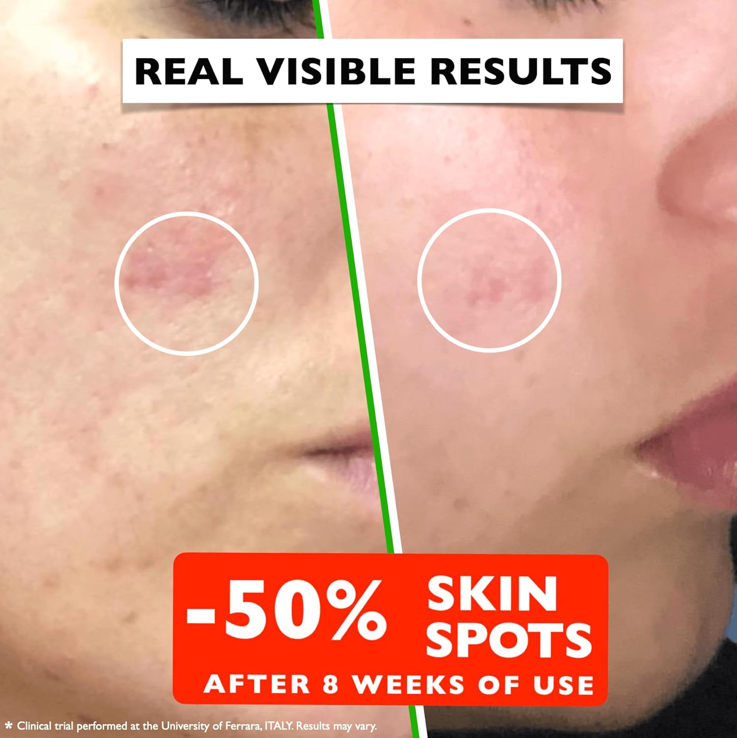 Vitamin C Serum For Face – Anti-Aging Facial Serum with Vitamin C, Hyaluronic Acid, Niacinamide, B5 & Vit E. Brightening Facial Essence for Dark Spots, Fine Lines, Wrinkles & Glowing Skin, 2 Fl Oz-Velvo Beauty