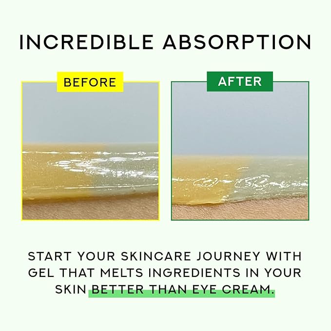 Gentle Relief Under Eye Patches | Calming Eye Treatment Gel Masks With 3-Cica Complex & Panthenol | Under Eye Masks For Dark Circles and Puffiness, Under Eye Bags, Wrinkle Care, Men and Women-Velvo Beauty