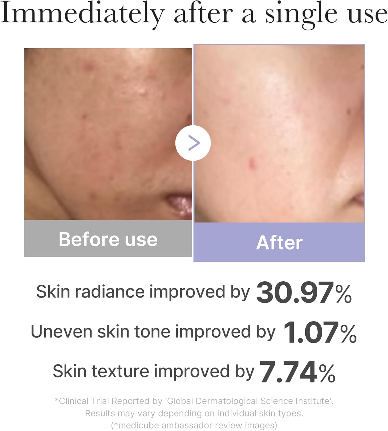 medicube Plump and Radiant Pink Duo: Mini Booster Pro Pink and Collagen Jelly Cream, 3.71 fl.oz. (110ml)-Velvo Beauty