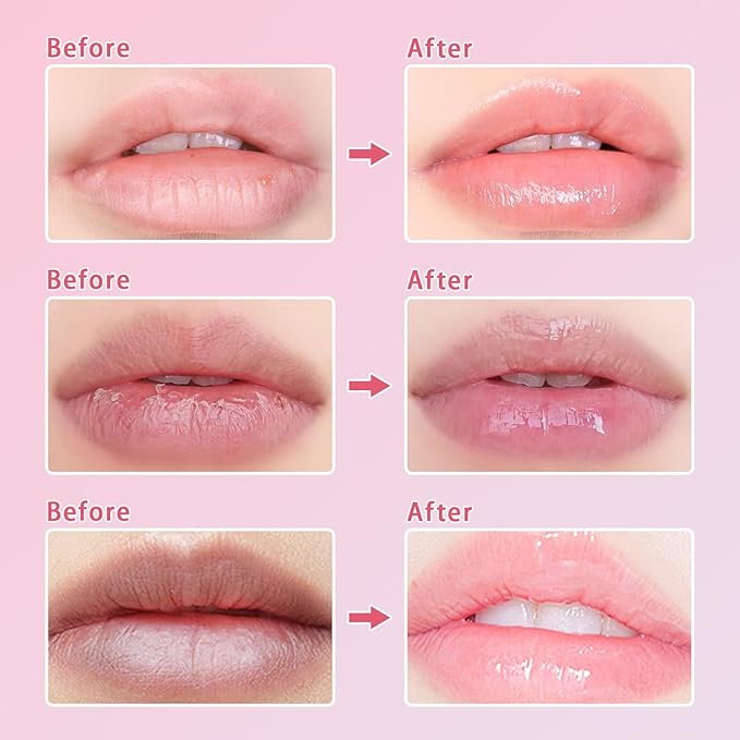 3 Pcs Bee Lip Balm Honey Pot, Cherry Watermelon Apple Lip Mask Overnight, Moisturizing Lip Sleeping Mask, Hydrate Repair Prevent Dry Cracked Lip Exfoliator Lip Care (Cherry+Watermelon+Apple Lime)-Velvo Beauty