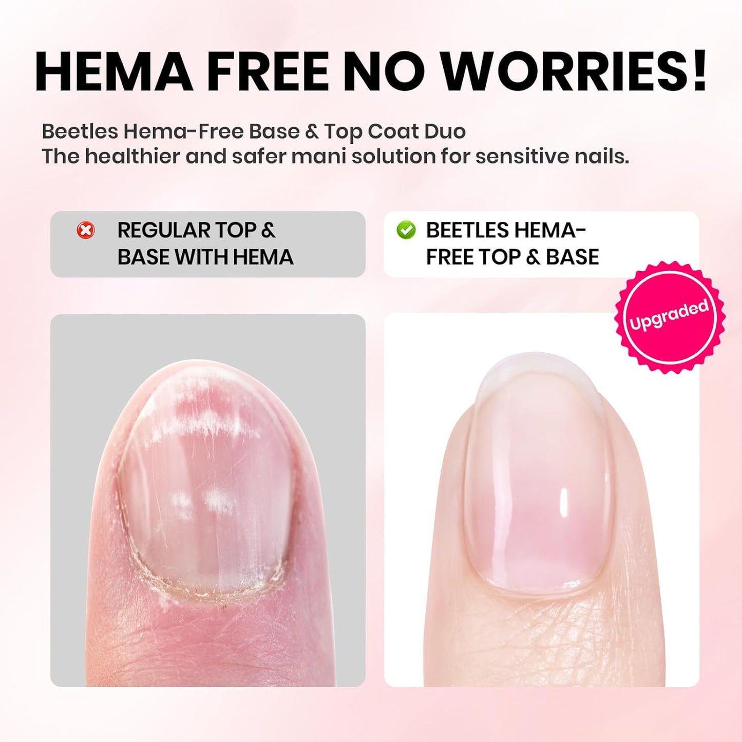 Beetles 15ml Gel Base and Top Coat Set HEMA Free, TPO Free Top Coat Gel Nail Polish & Base Clear Glossy Long Lasting No Wipe Soak Off Upgraded Safe Low-Sensitivity, No More Damaged Gifts for Women-Velvo Beauty