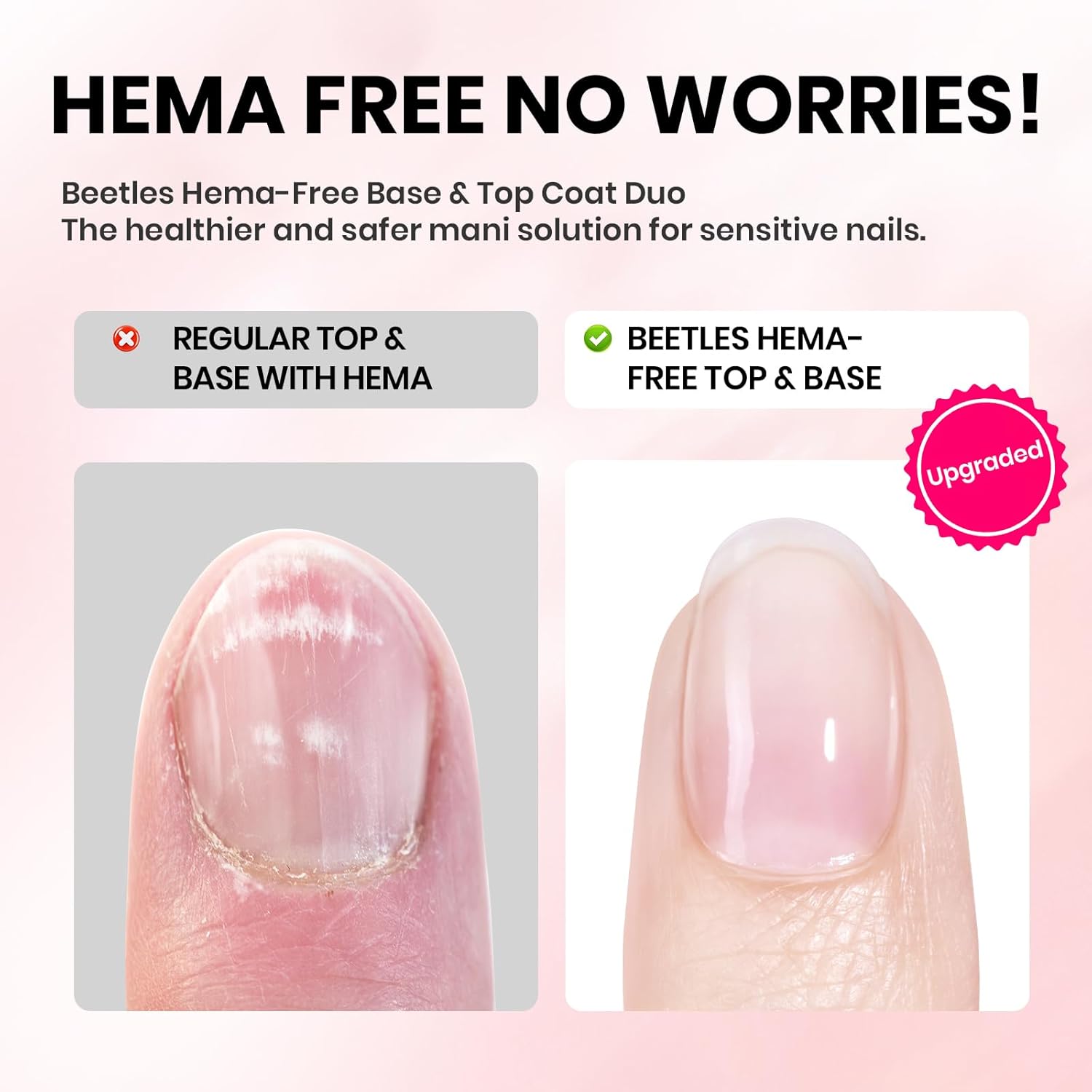 Beetles 15ml Gel Base and Top Coat Set HEMA Free, TPO Free Top Coat Gel Nail Polish & Base Clear Glossy Long Lasting No Wipe Soak Off Upgraded Safe Low-Sensitivity, No More Damaged Gifts for Women-Velvo Beauty