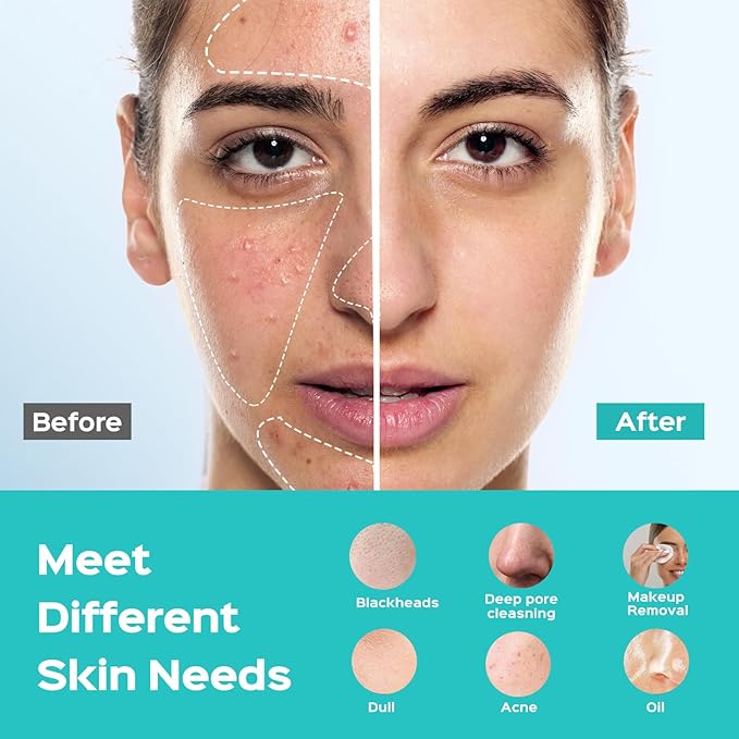 COSLUS Facial Cleansing Brush Face Scrubber : Silicone Waterproof Rechargeable Face Wash Brush, 5 Cleansing Modes, Electric Deep Cleaning for Men & Women, Removing Blackhead, Exfoliating, Massaging-Velvo Beauty