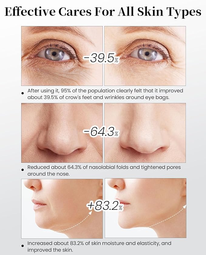 4-in-1 Facial Massager for Face & Neck – Skin Rejuvenation, Lifting & Tightening – Reduces Wrinkles & Puffiness, Enhances Infusion-Velvo Beauty