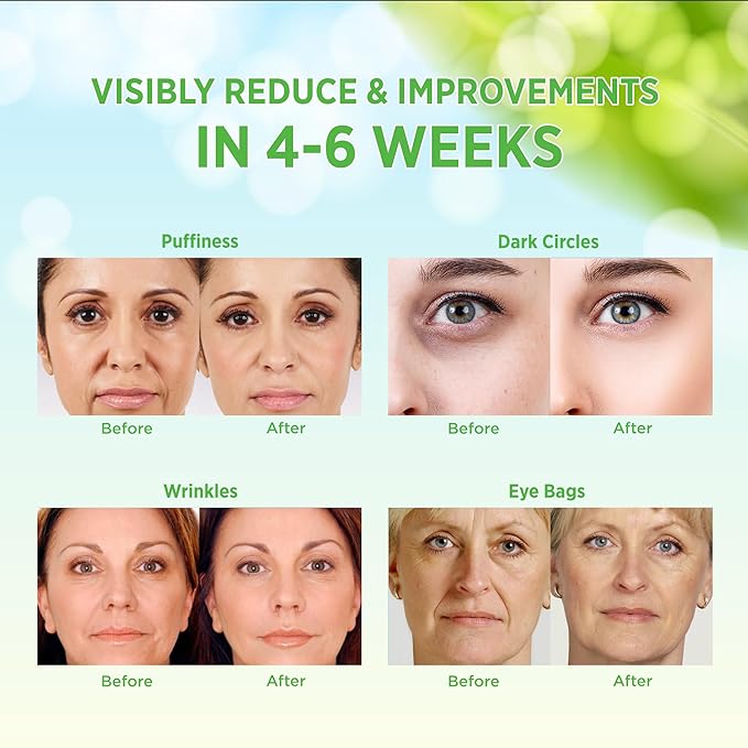 VELAMO ADVANCED Under Eye Patches: Aloe Vera Under Eye Mask for Dark Circles - Retinol Eye Patches for Wrinkles and Puffiness - Under Eye Bags Dark Circles Treatment for Women and Men 60 Pcs-Velvo Beauty