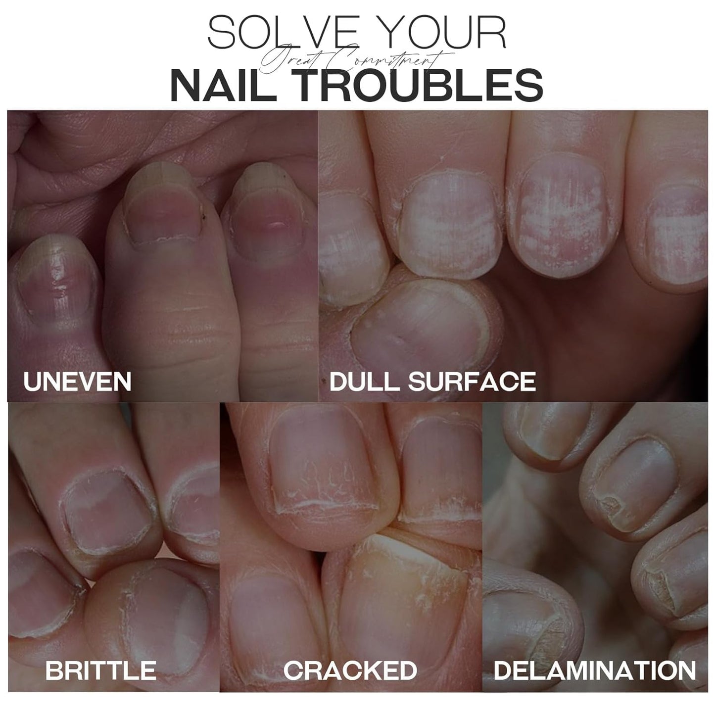 Base Top Coat Nail Polish: 3 in 1 Clear Quick Dry Nail Polish Nail Strengthener and Growth Hardener for Nail Treatment Repair Damaged Nail Care 0.5 fl oz-Velvo Beauty