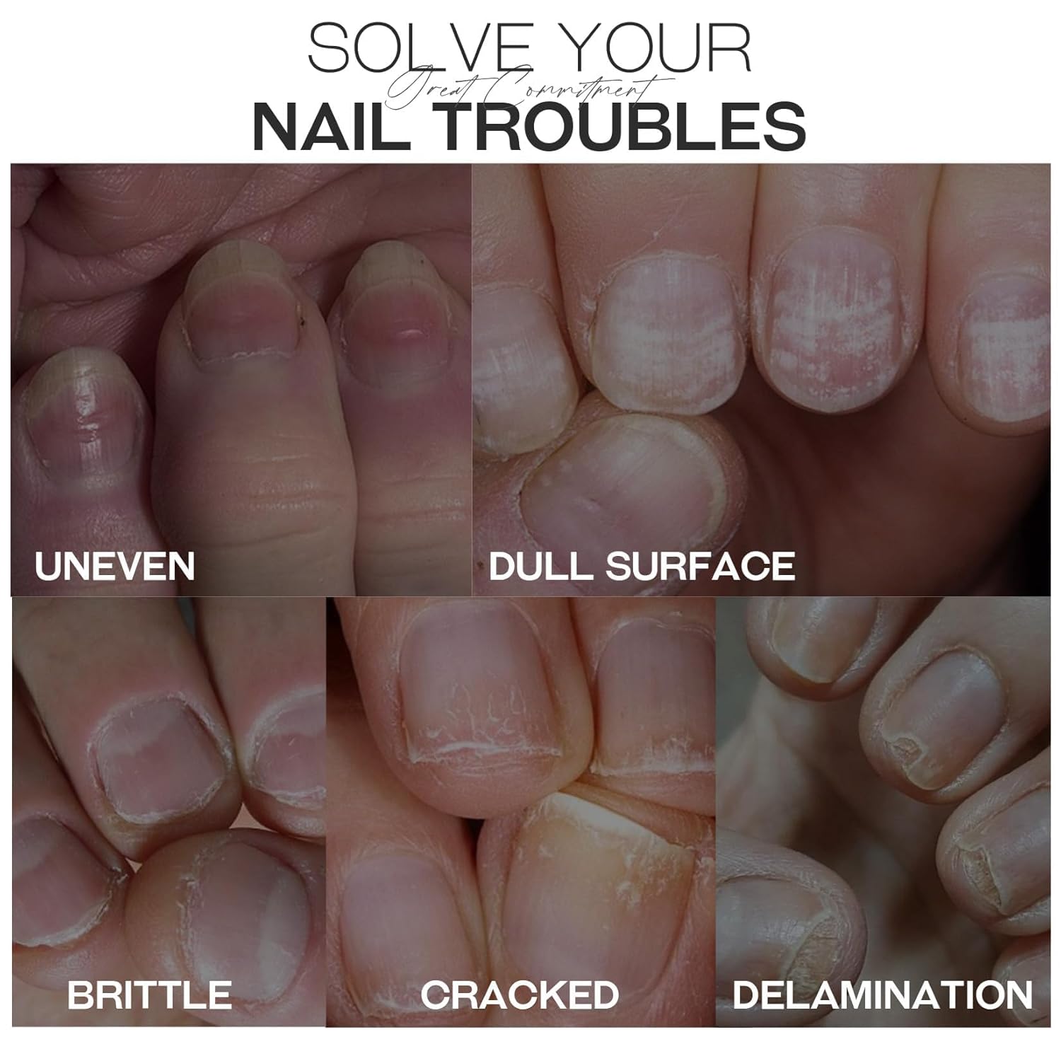 Base Top Coat Nail Polish: 3 in 1 Clear Quick Dry Nail Polish Nail Strengthener and Growth Hardener for Nail Treatment Repair Damaged Nail Care 0.5 fl oz-Velvo Beauty