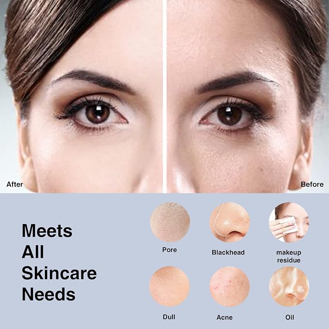 NågraCoola Electric Facial Cleansing Brush - Waterproof and Rechargeable, Exfoliates, Cleanses and Massages Skin - Light Blue-Velvo Beauty