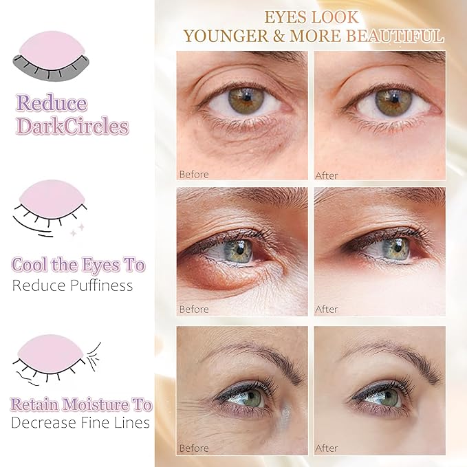 MOND'SUB Premium Under Eye Patches, Gel Eye Patches Hydrating & Refresh for Puffy Eyes, Under Eye Bags & Dark Circles, Natural Collagen Eye Gels Pads, Crystal Anti-Aging Eye Mask (Pink)-Velvo Beauty