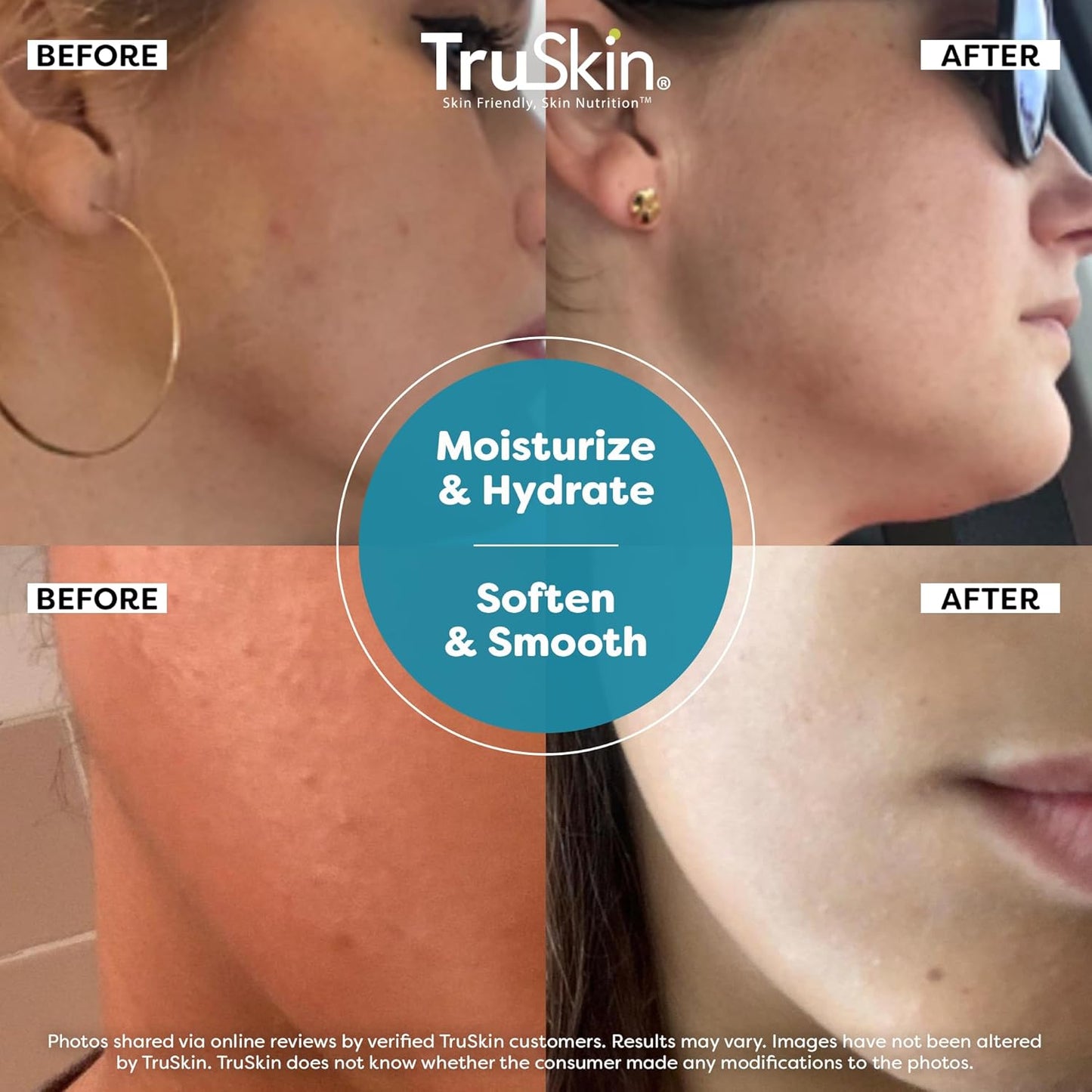 TruSkin Hyaluronic Acid Serum for Face + 7 Ultra Hydrating Ingredients – Best Face Serum for Moisturizing, Visibly Plumping Skin & Smoothing the Look of Fine Lines, 1 fl oz-Velvo Beauty