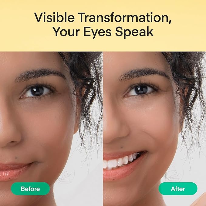 Terez & Honor Under Eye Patches - 180 Pcs Korean Self Care Hydrogel Eye Masks for Puffy Eyes, Dark Circles, Fine Lines, Wrinkles & Undereye Bags - Radiant Eyes Trio with Caffeine, Collagen & Vitamin C-Velvo Beauty