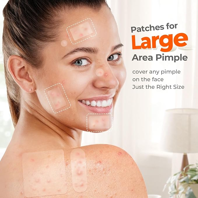 Large Acne Patches for Face, 7 Sizes Big Pimple Patches, XL Hydrocolloid Bandages for Body, Chin, Forehead, Nose, Back Blemish Zit Breakouts, Hydrocolloid Patch (Square, Strip, Dot 142 Count)-Velvo Beauty
