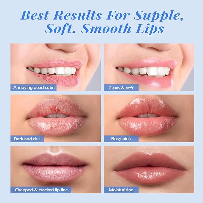 ANAI RUI Lip Therapy Set, Lip Scrub & Lip Mask, Overnight Moisturizing Lip Care Kit, Suagr Lip Exfoliator and Lip Sleeping Mask for A Soft Lips, Lip Gift Set for Dry, Chapped, Dark Lips, Blueberry-Velvo Beauty