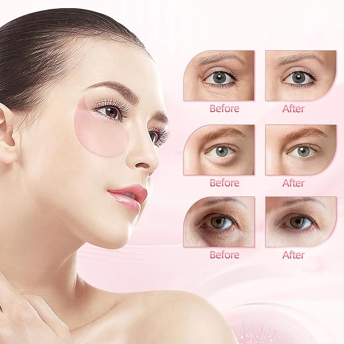 Under Eye Patches (30 Pairs), Eye Mask for Puffy Eyes, Dark Circles,Bags and Wrinkles with Collagen,Relieves Pressure and Reduces Wrinkles-Velvo Beauty
