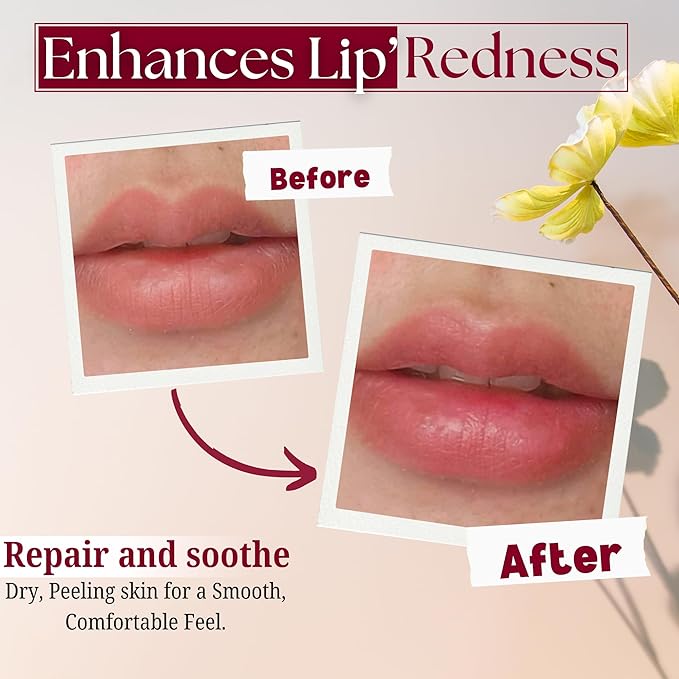 Merlena Pink Lip & Nip Serum - Hydrates and Repairs Dry, Peeling Lips and Nipples, Adds Collagen for Plumpness, Soothes Flaky Skin, Organic Vitamin C & E Formula 8ml-Velvo Beauty