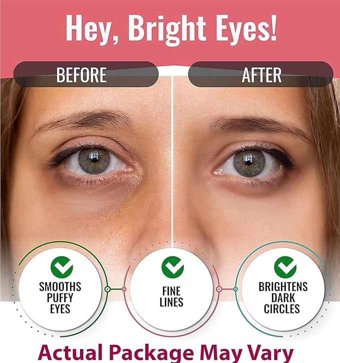 Eye Mask for Puffiness - Under Eye Patches for Dark Circles - Korean Under Eye Mask Patches for Puffy Eyes - Eye Gel Pads Depuffing Eye Brightener with Rose, Caffeine, Hydrogel & Collagen (10 Pairs)-Velvo Beauty