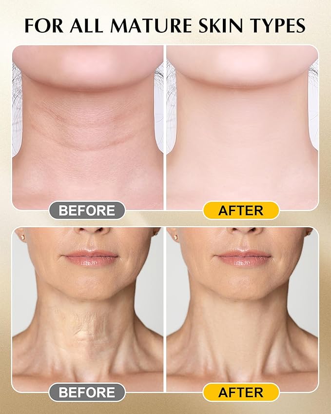 Neck Firming Cream with 3% Retinol - Hyaluronic Acid, Anti-Wrinkle Treatment, Skin Tightening Cream for Face, Neck, Chest & Décolleté-Velvo Beauty