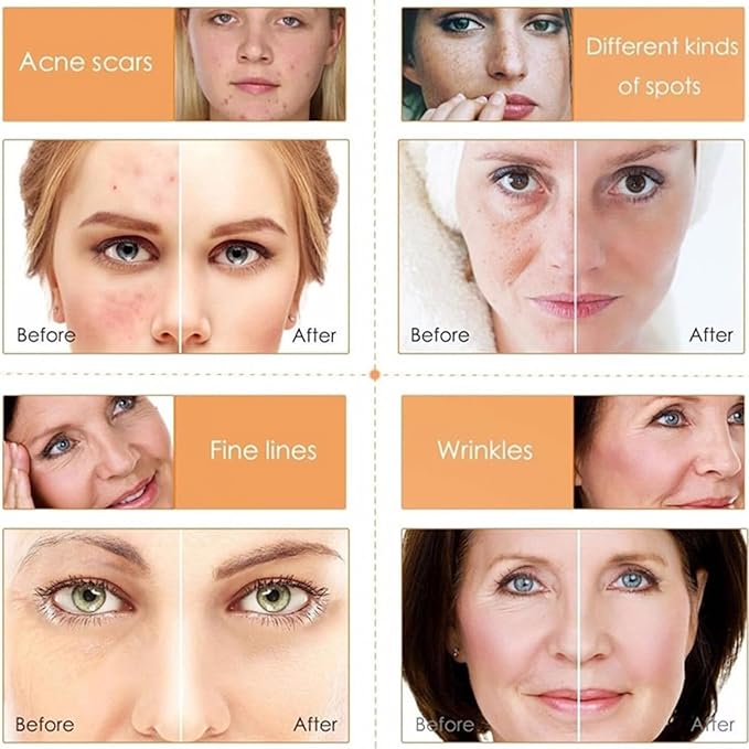 Vitamin C Skin Care Sets, 6Pcs Skin Care Products Set, Skin Care Gift Set for Women Girls, Hydrating Skincare Routine Set, Face Care Kit Includes Cleanser, Mask, Face Serum, Toner, Cream-Velvo Beauty