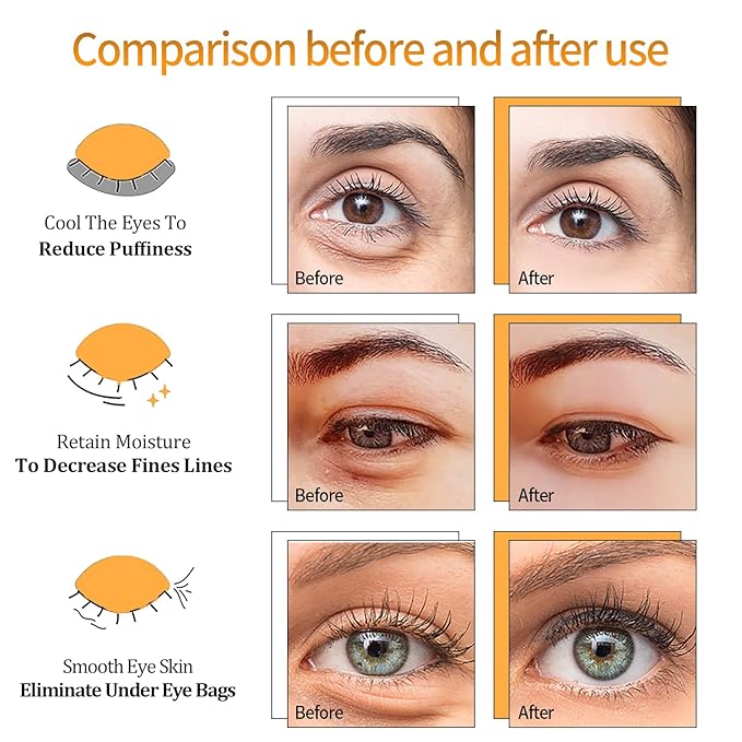 Black Truffle Gold Under Eye Patches - 60pcs Hyaluronic Acid Eye Masks for Moisturizing, Collagen Eye Gel Pads Removing Dark Circles,Wrinkles,Puffiness And Bags-Velvo Beauty