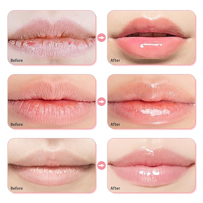 3 Pcs Bee Lip Balm Honey Pot, Honey Strawberry Watermelon Lip Mask Overnight, Moisturizing Sleeping Lip Mask, Hydrate Repair Prevent Dry Cracked Lip Care (Honey+Strawberry+Watermelon)-Velvo Beauty