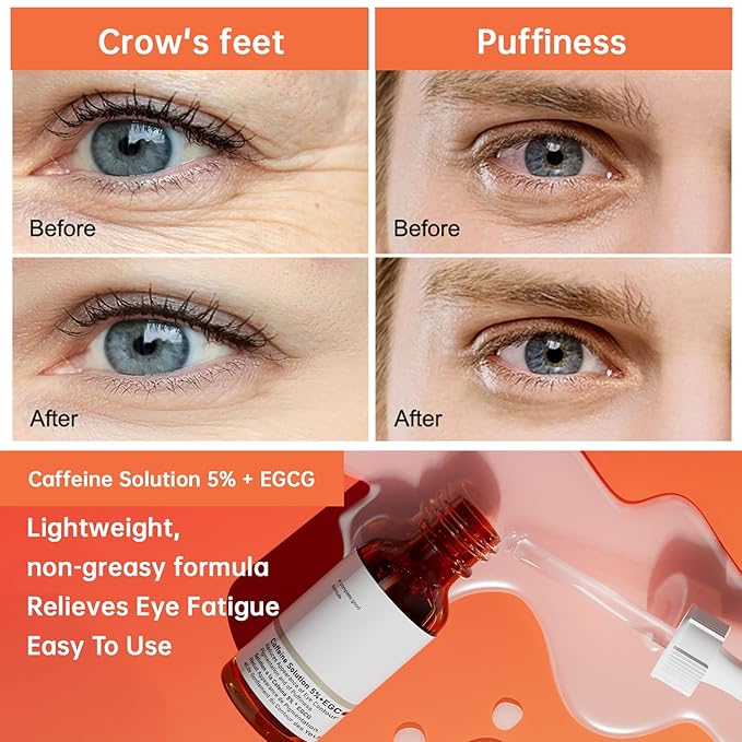 The Caffeine Solution 5% + EGCG，Reduces Appearance of Eye Contour Pigmentation and Puffiness，Under Eye Serum (30ml) Caffeine For Face Moisturizing Serum (2)-Velvo Beauty