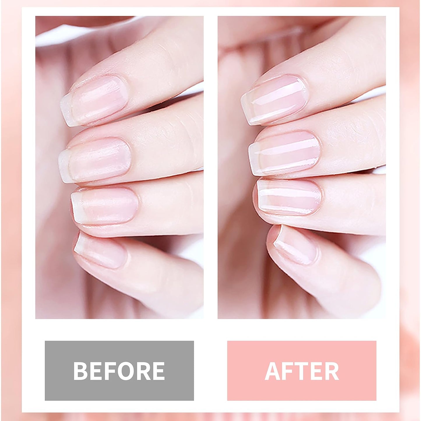 4in1 Nail Hardener Nail Strengthener Nail Rescue Calcium Primer for Thin Nails Growth Nail Repair Nail Care Kit with Cuticle Oil Cuticle Remover Gel Cream-Velvo Beauty