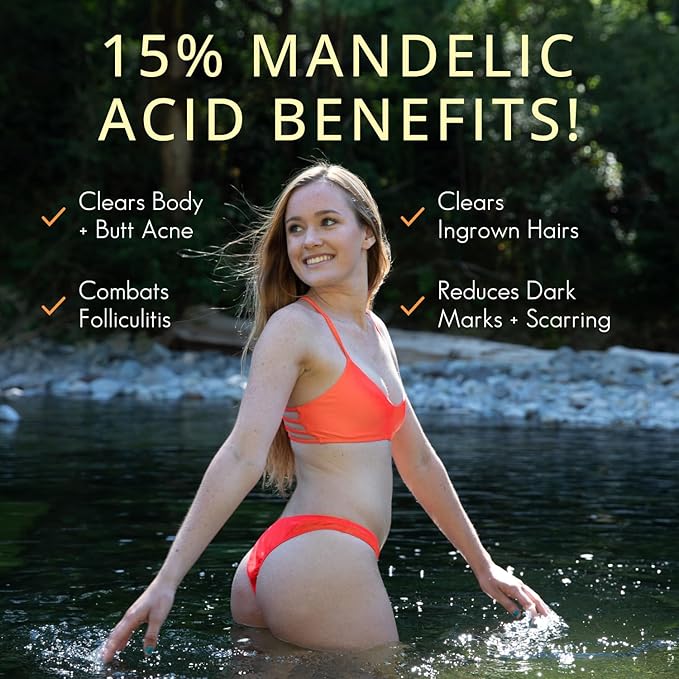 Level 2 Serum | Mandelic Acid Body Serum for Acne, Folliculitis, Aging Skin, Ingrown Hairs, Dark Spots on Face, Chest, Butt, Back, Thighs, Arms | 4 oz-Velvo Beauty