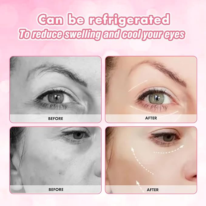 Under Eye Patches Silicone, 3 Pairs Reusable Under Eye Patches With Metal Eye Cream Applicator, Reusable Under Eye Mask Eye Pad For Minimize Fine Lines Wrinkles, Visible Metal Case-Velvo Beauty