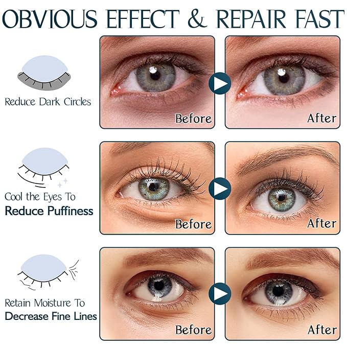 Under Eye Patches (60PCS), Aloe Vera & Collagen Eye Mask, Eye Patches for Puffy Eyes, Anti-Aging Eye Mask for Puffiness, Under Eye Mask for Dark Circles and Eye Bags, Hydrating Eye Gel Pads(green)-Velvo Beauty