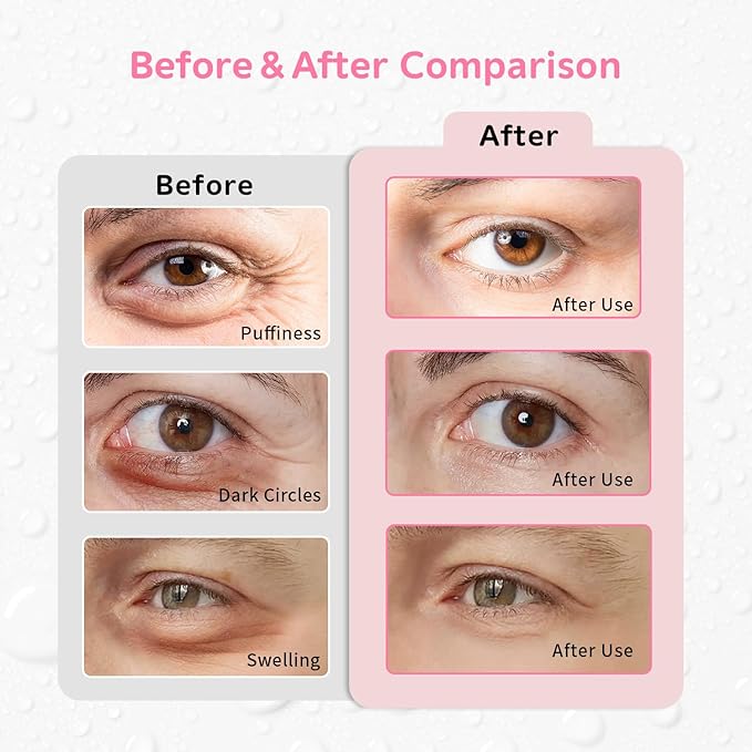 Gel Ice Pack Reusable Cooling Eye Pads and Under Patches,Eye Hot Cold Treatment for Redness,Pain Relief Relax (Butterflies)-Velvo Beauty