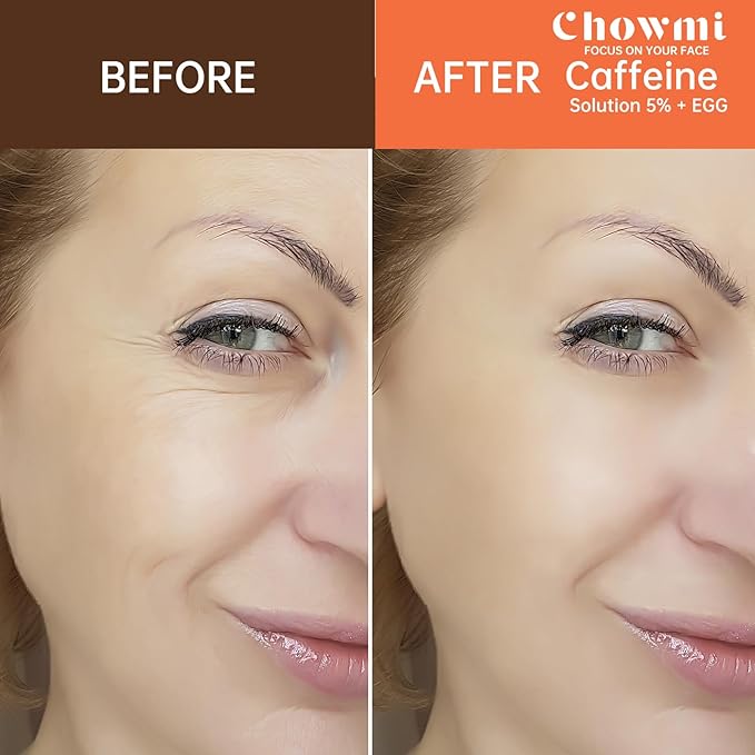 The Caffeine Solution 5% + EGCG，Reduces Appearance of Eye Contour Pigmentation and Puffiness，Under Eye Serum (30ml) Caffeine For Face Moisturizing Serum (2)-Velvo Beauty