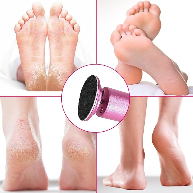 Electric Foot Callus Remover, Adjustable Foot Speed, Professional Foot Repair Tool, Equipped with 60 Pieces of Sandpaper, Suitable for Men and Women with Dead Skin calluses, Dry and Cracked, Pink-Velvo Beauty