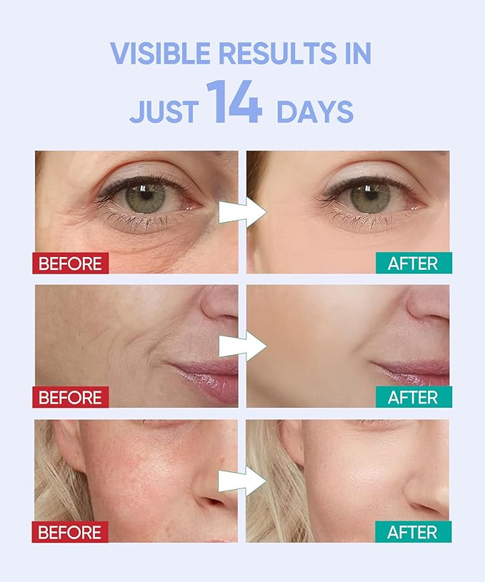 Led Face Mask Light Therapy, Red Light Therapy for Face, 7-1 Colors LED Facial Skin Care Mask, Black-Velvo Beauty