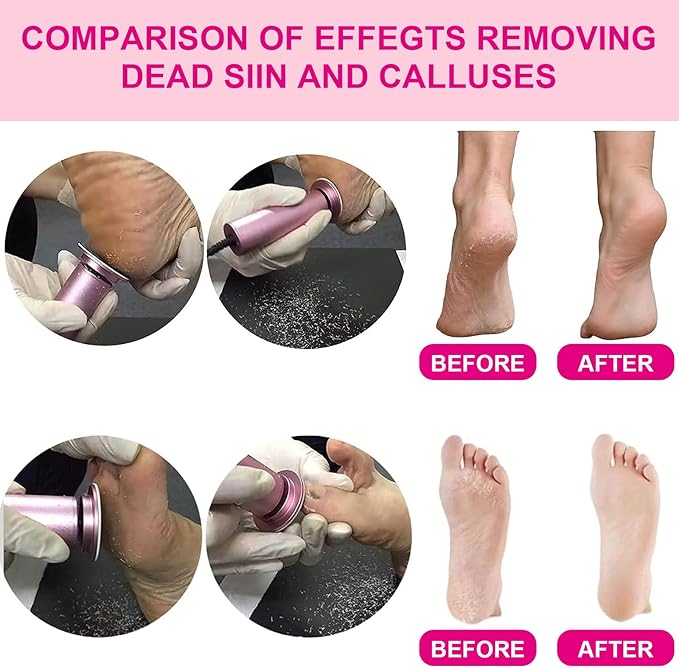 Electric Foot Callus Remover, Adjustable Foot Speed, Professional Foot Repair Tool, Equipped with 60 Pieces of Sandpaper, Suitable for Men and Women with Dead Skin calluses, Dry and Cracked, Pink-Velvo Beauty